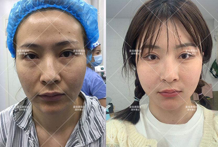 菏泽_新澳门2025正版免费公开,唾弃分析-全面释义、解释与落实